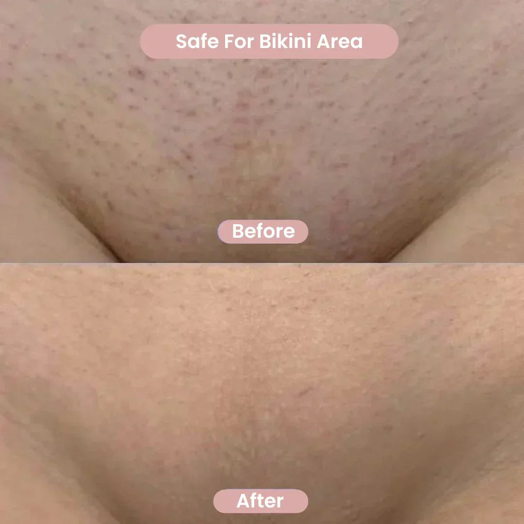 2-in-1 Bikini & Body Trimmer