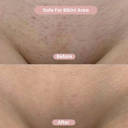 2-in-1 Bikini & Body Trimmer