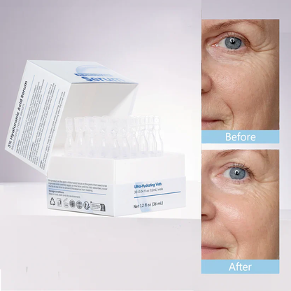 3% Hyaluronic Acid Ultra Hydrating Serum✨-zd