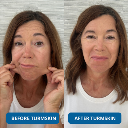 3% Hyaluronic Acid Ultra Hydrating Serum✨-zd