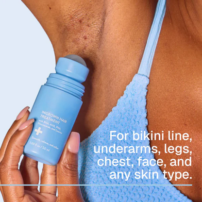 trinous: Smoothing Solution For Ingrown Hairs
