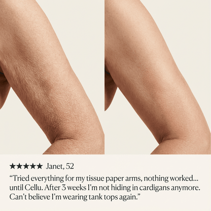 Crepey Skin Repair Cream