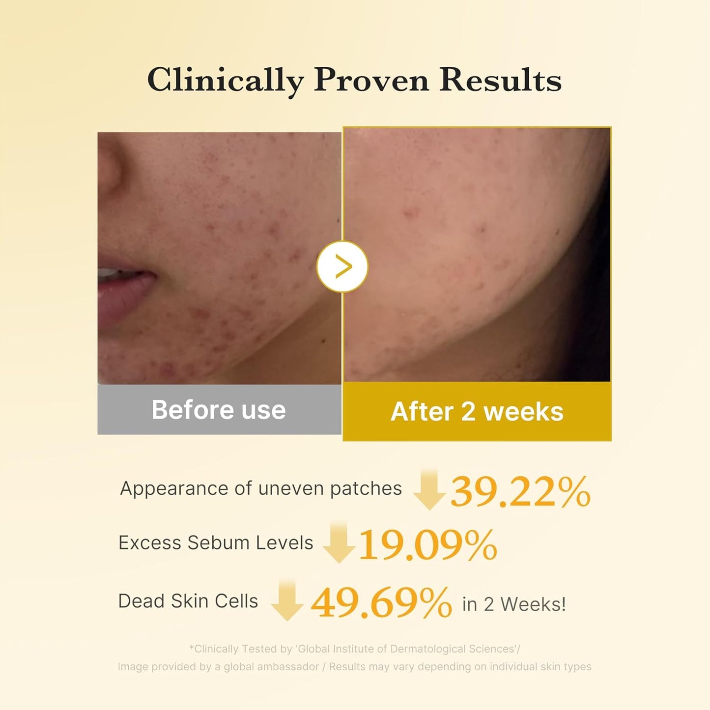 Kojic Acid Turmeric Power Duo