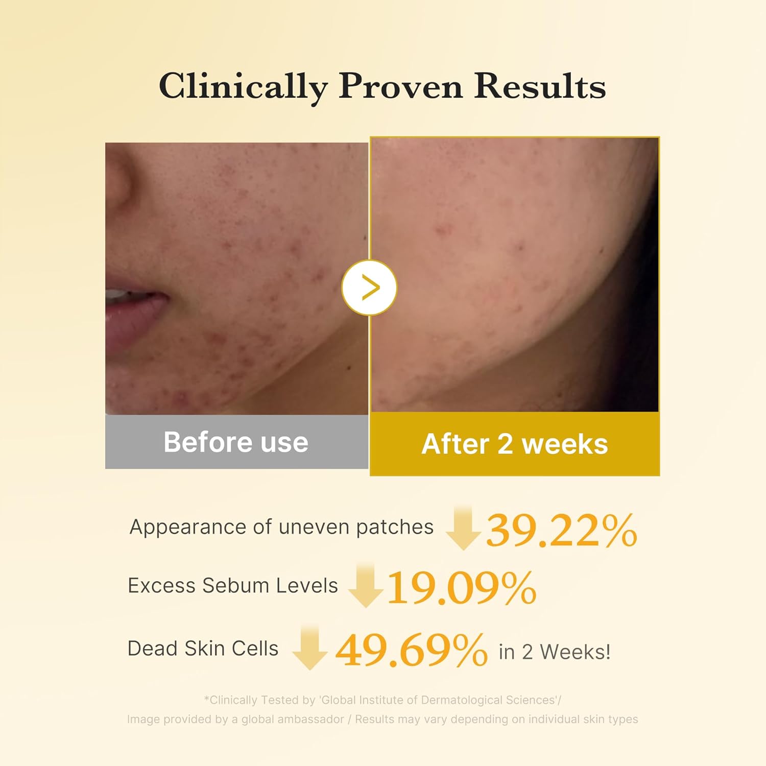 Kojic Acid Turmeric Power Duo
