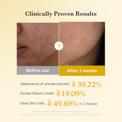 Kojic Acid Turmeric Power Duo