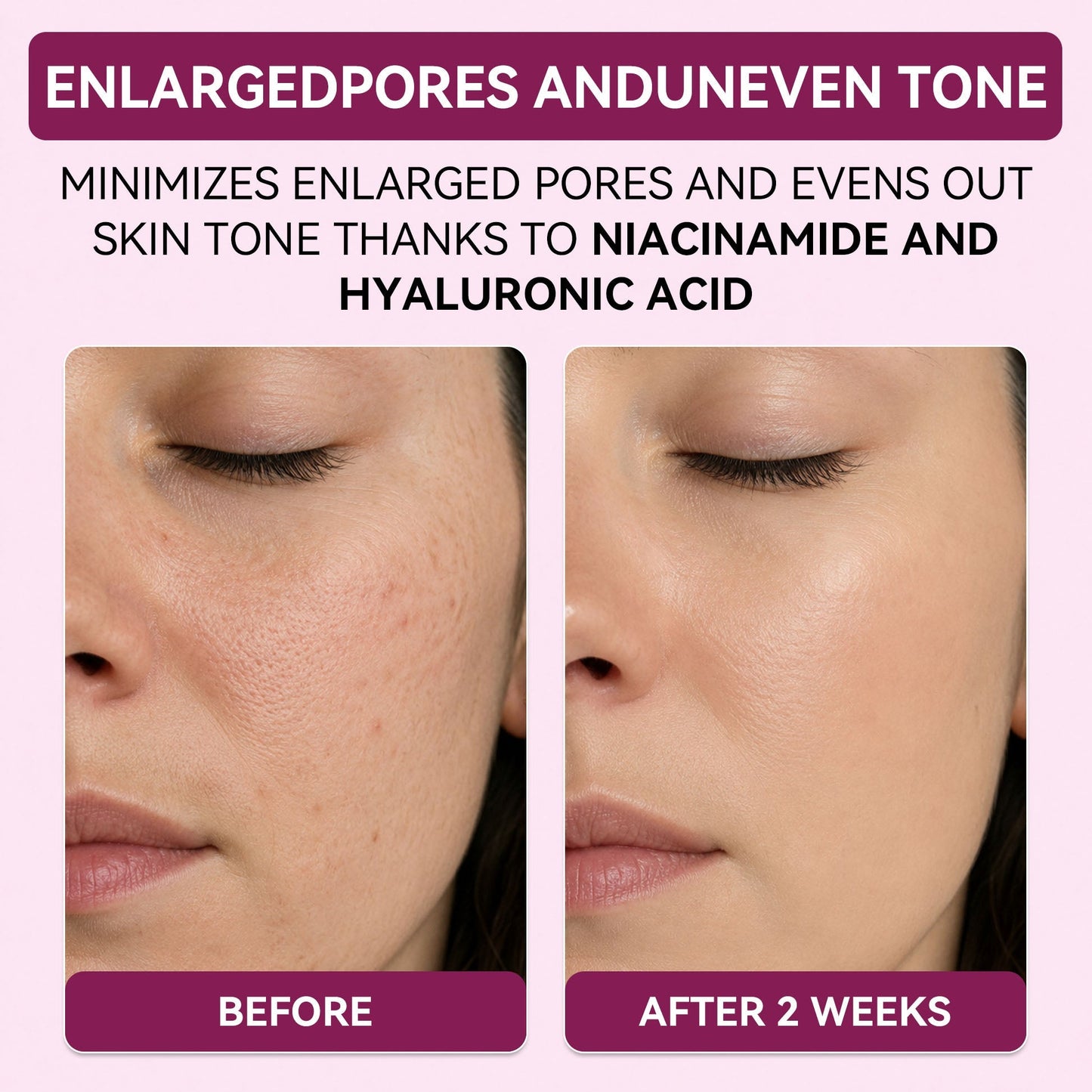Regenerating Mask with Hydrolyzed Collagen and Niacinamide