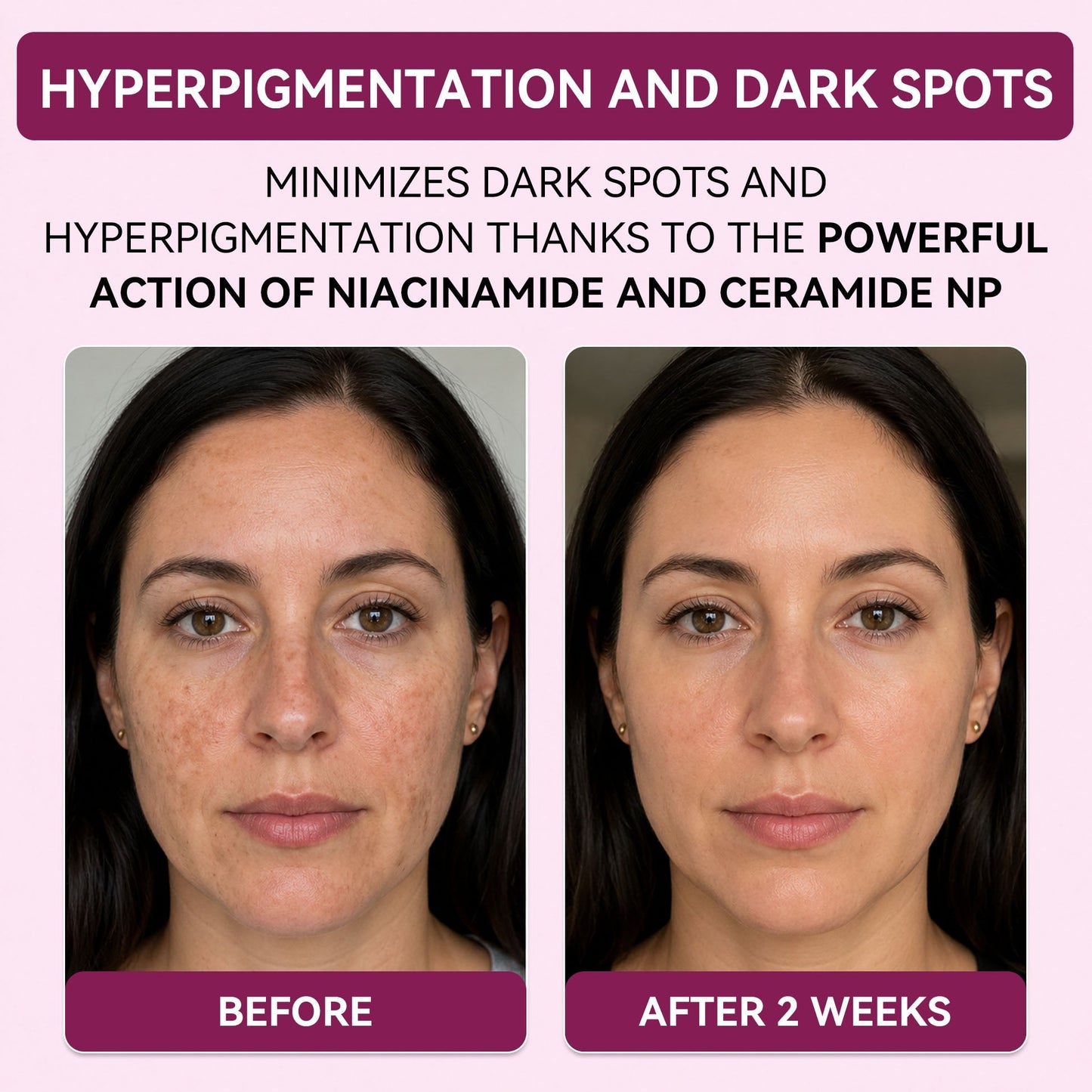 Regenerating Mask with Hydrolyzed Collagen and Niacinamide