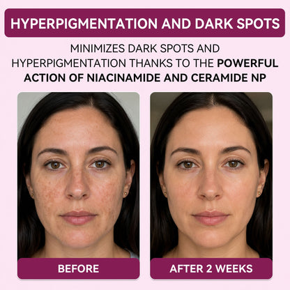 Regenerating Mask with Hydrolyzed Collagen and Niacinamide