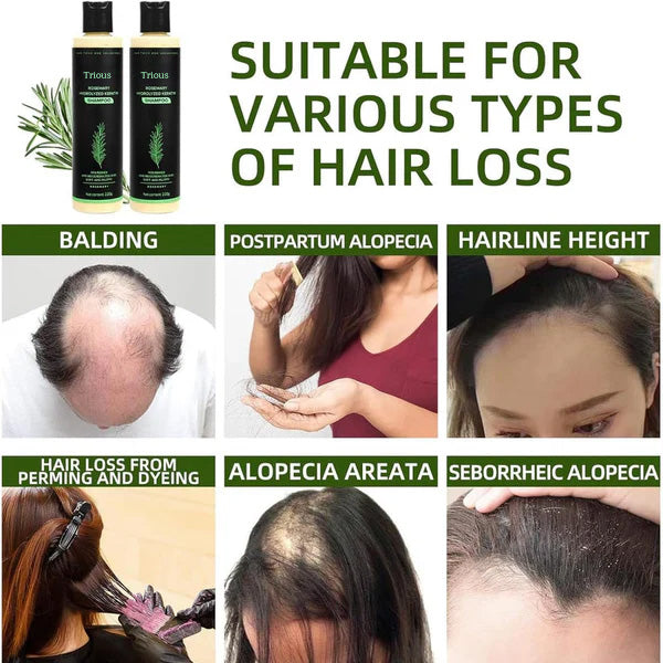 Jszbdf Rosemary Shampoo
