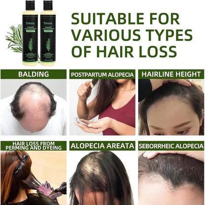 Jszbdf Rosemary Shampoo