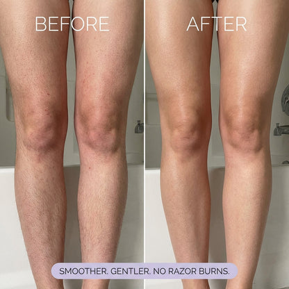 trinous Hair Removal Mousse