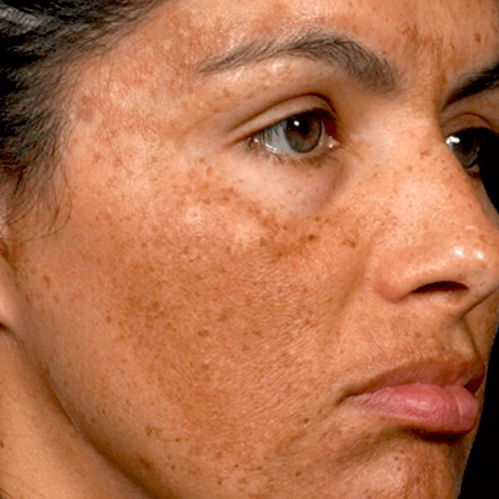 Helps_with_Dark_spots_imperfections-min.jpg