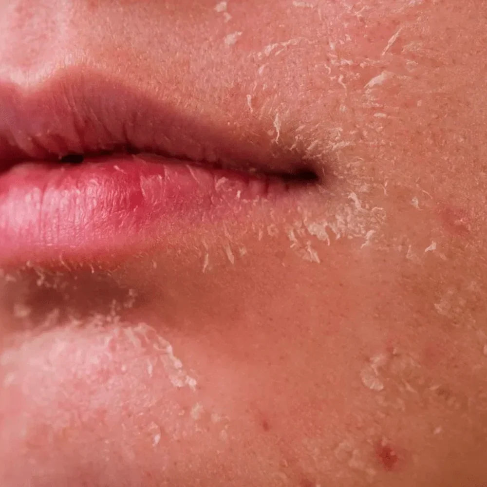 Helps_with_Dryness_dehydration-min.jpg