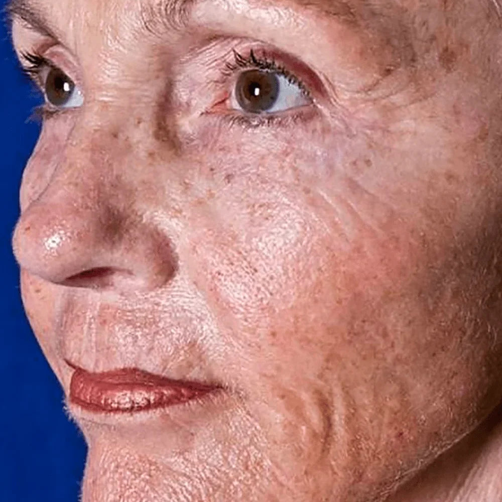 Helps_with_Sun-Damaged_Skin-min.jpg