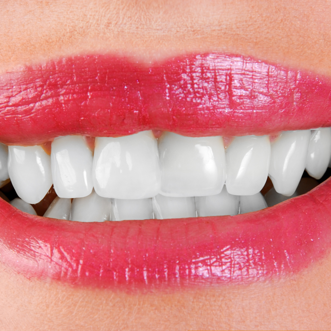 Hismile_V34_Whitening_Strips_21.png