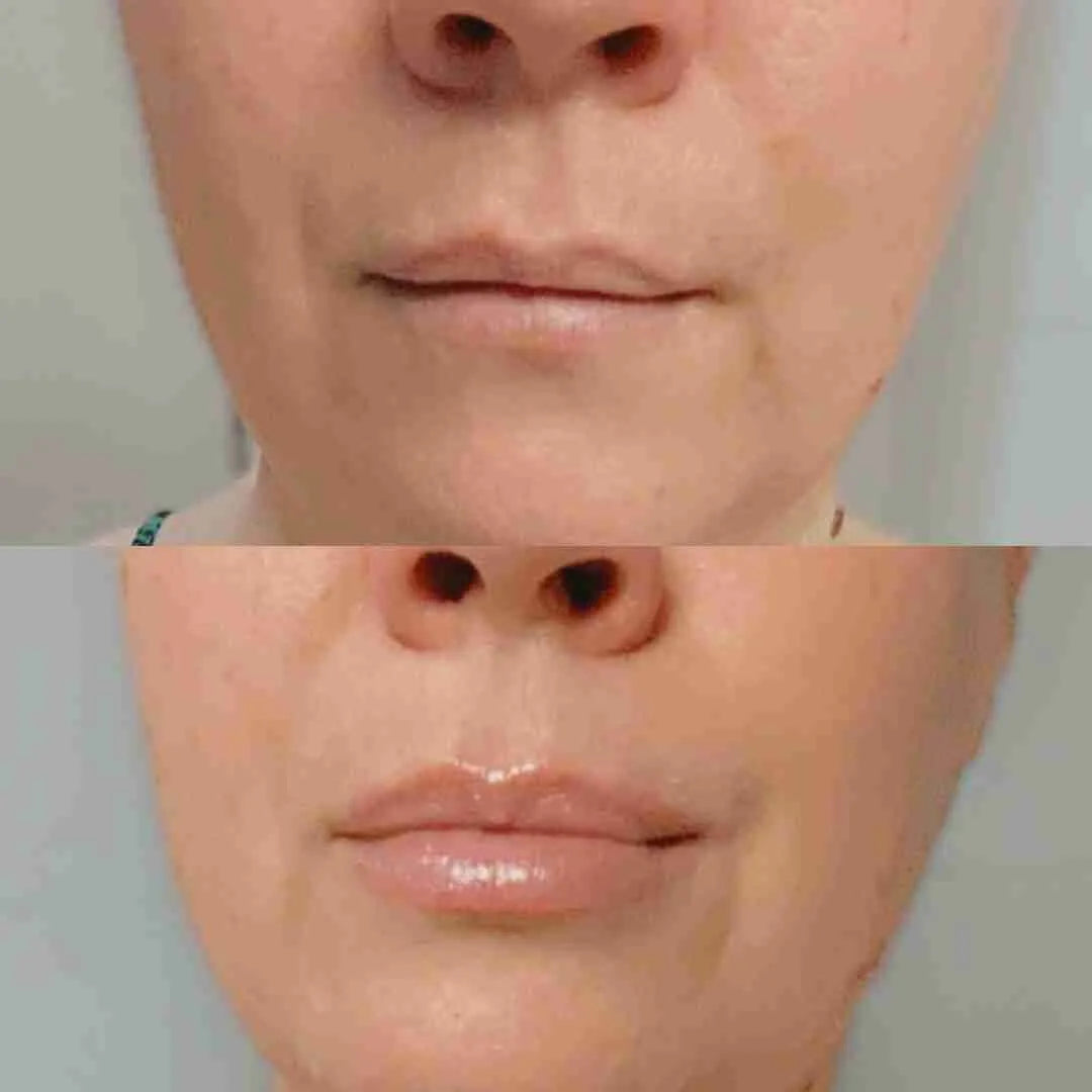 LIp-Plumper-ApocaLips.webp