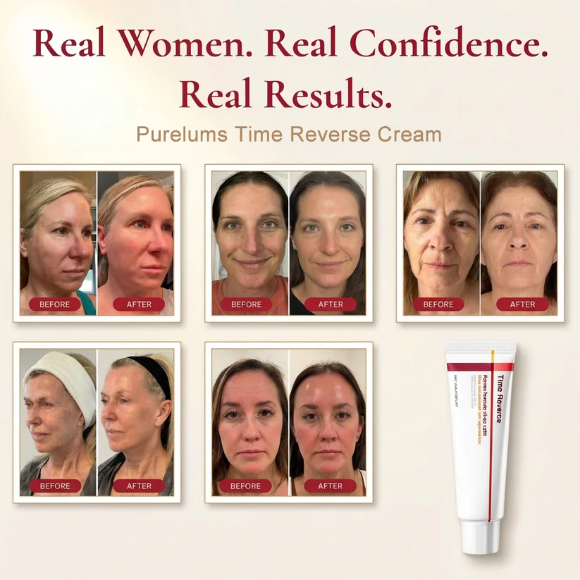 trinous - Time Reverse Cream