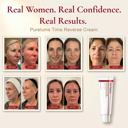 trinous - Time Reverse Cream