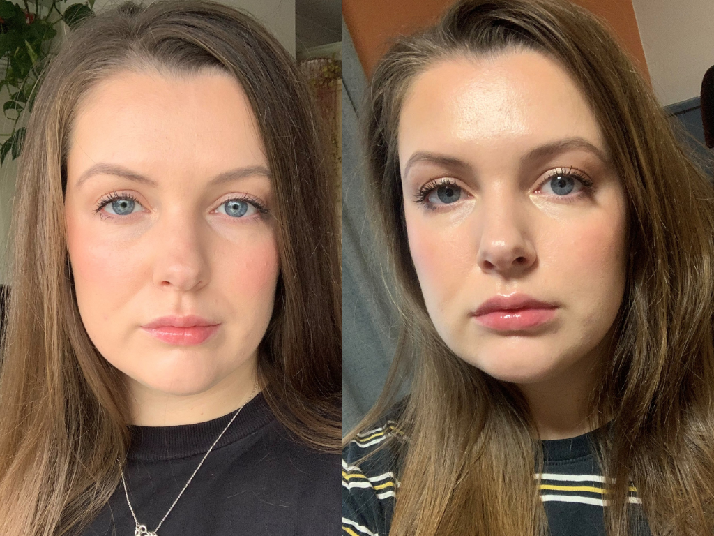 before-and-after-dr-dennis-gross-lip-plump-gee.png