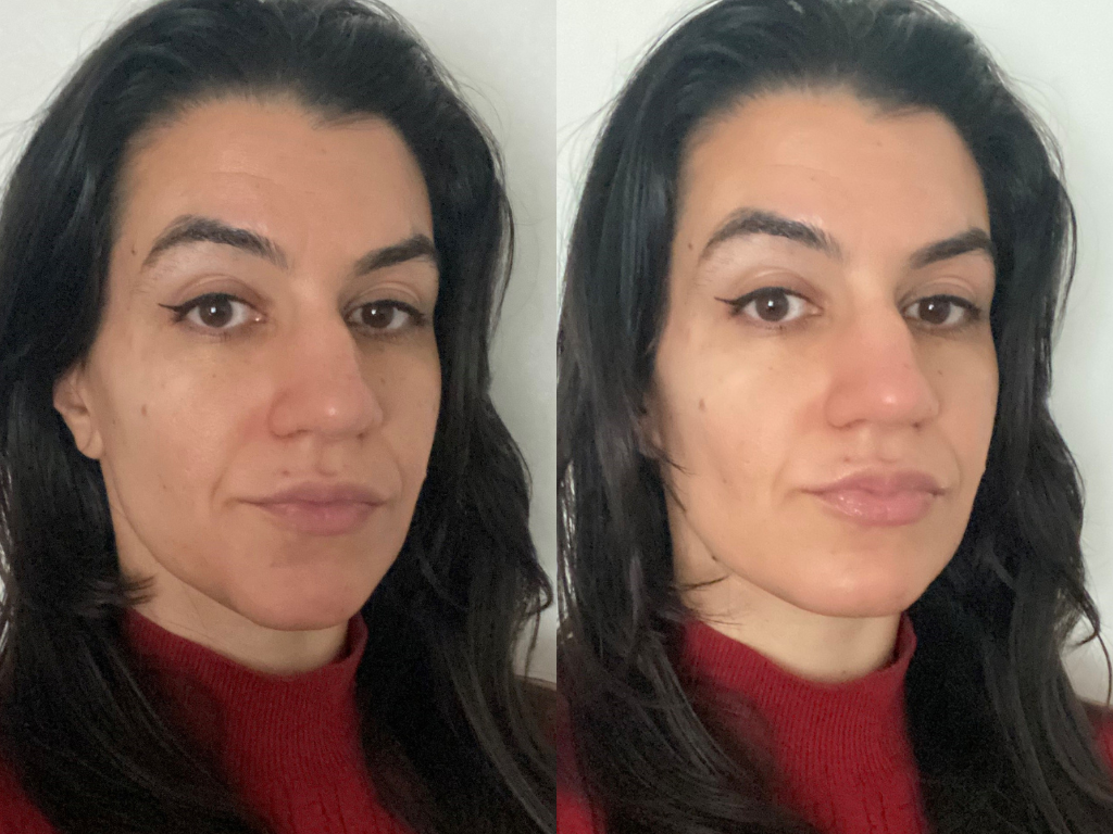 before-and-after-dr-dennis-gross-lip-plump-vanessa.png