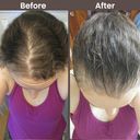 beforeafter3.png