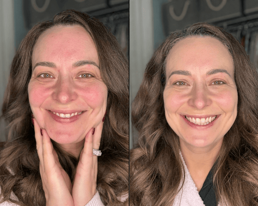 derma_before_after_1_34186ca1-0ea9-42e9-bf1b-2ab696c719e1.png