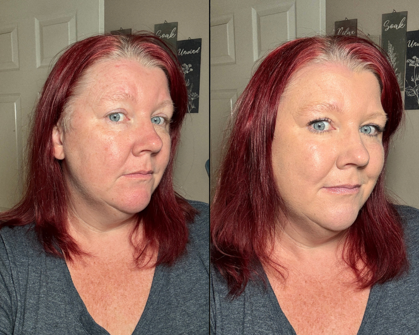 derma_before_after_3_08fa253b-3849-414c-b162-1ee5d084da06.png