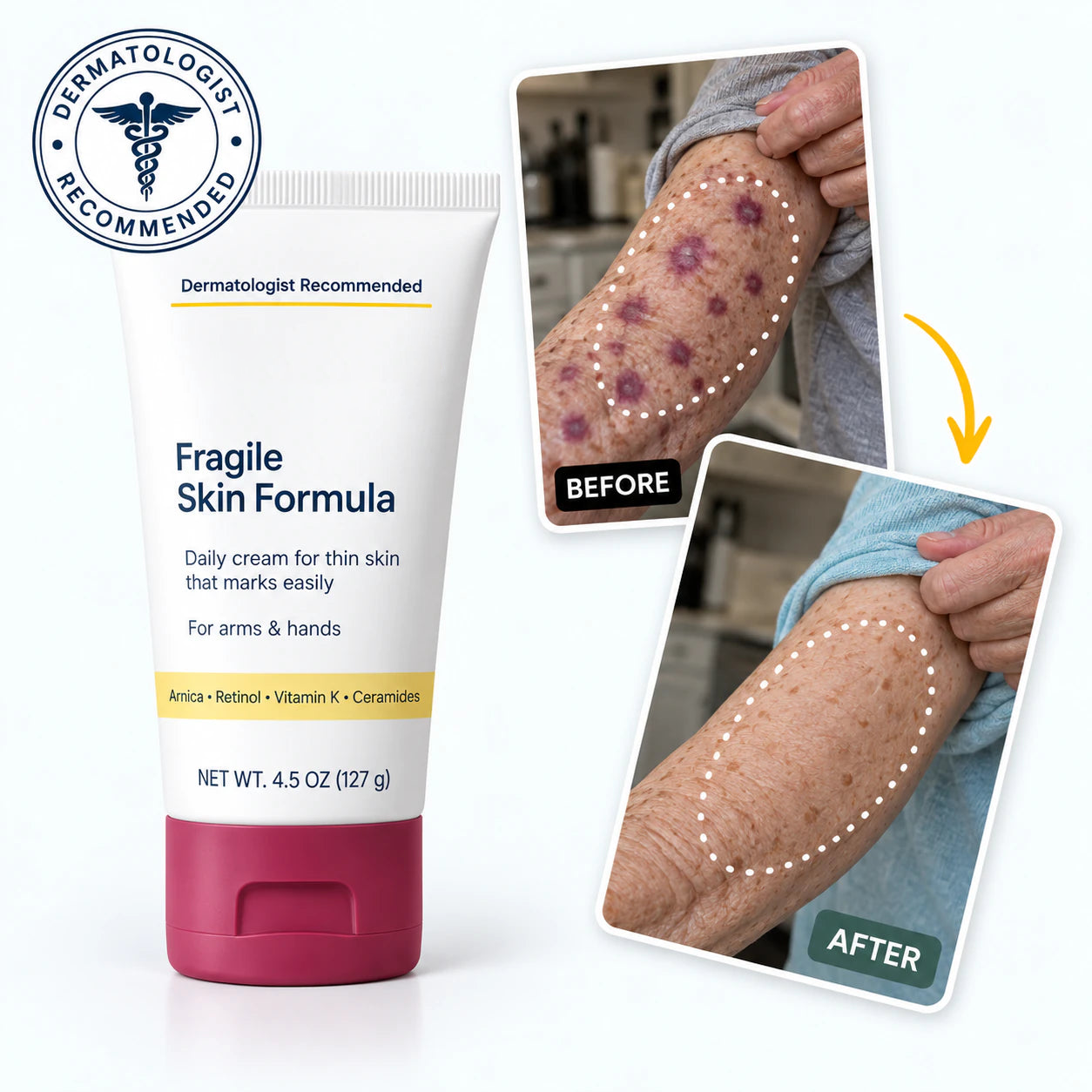  jszbdf  Fragile Skin Formula with before-and-after forearm imagery