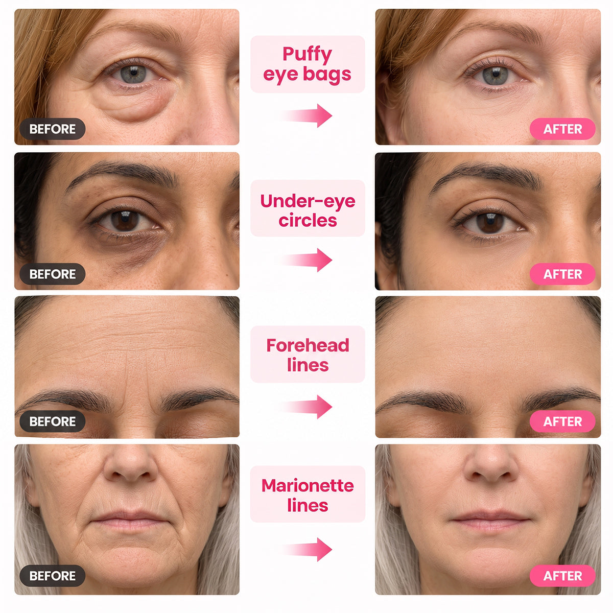 K-Lift™ Instant Lift Serum | PDRN + Peptides — image 2