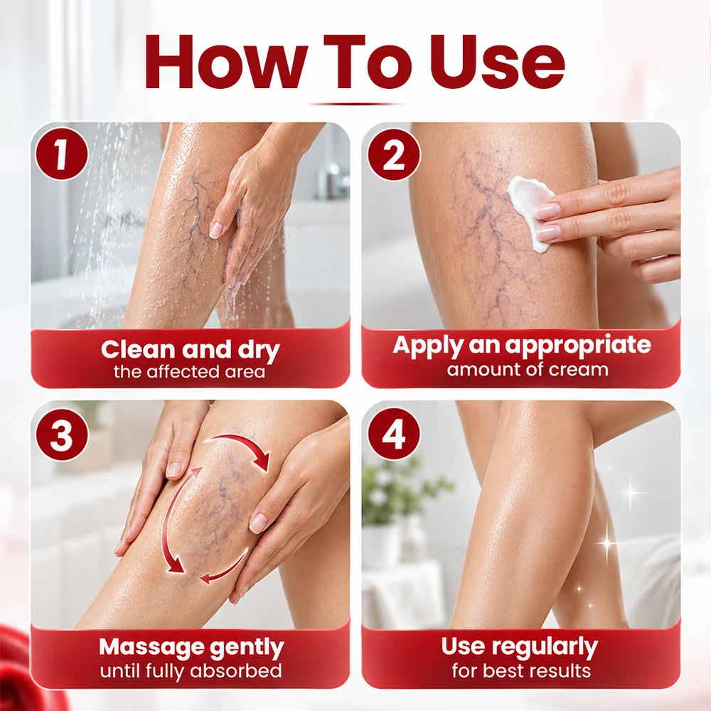 Varicose & Spider Vein Relief Cream