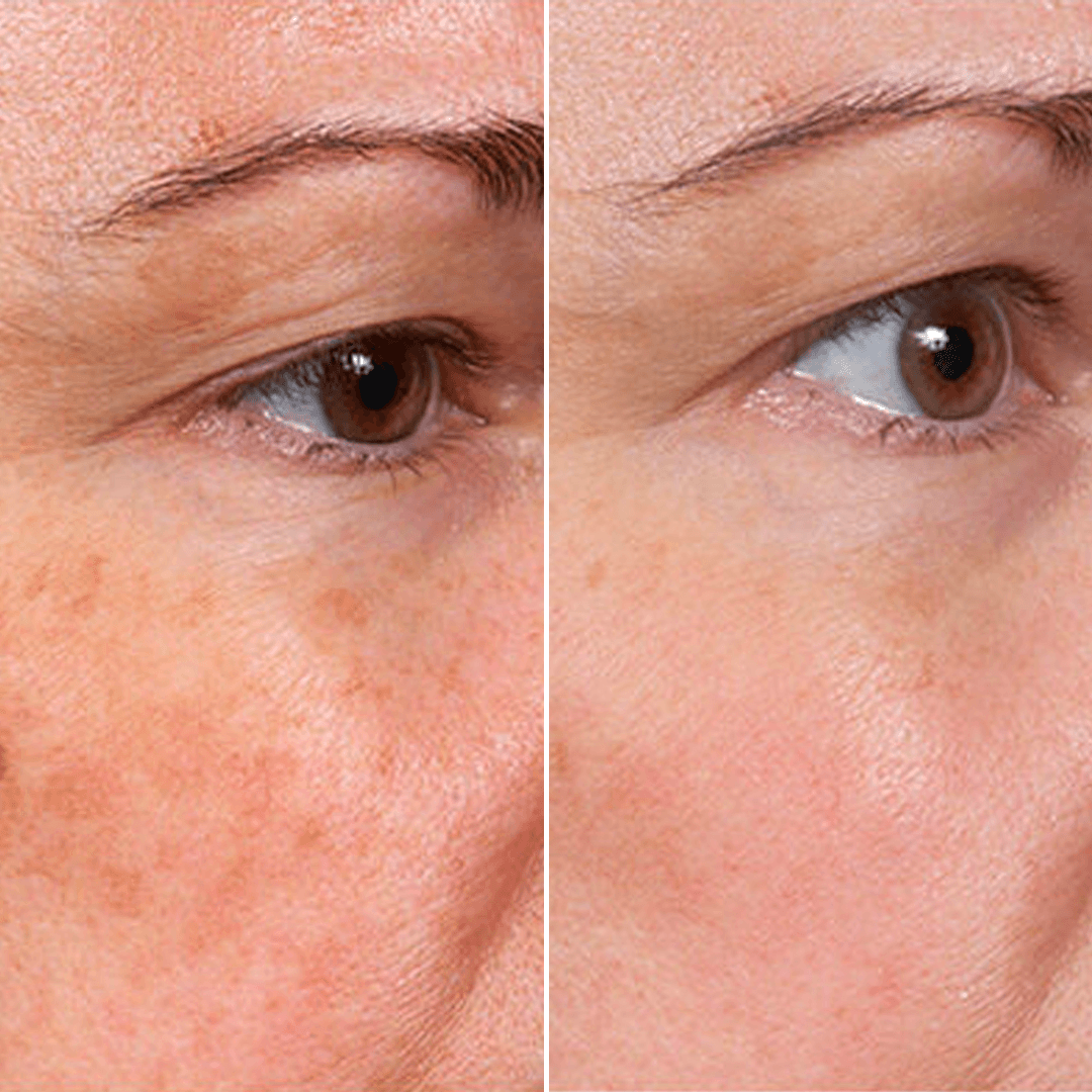 trinous Face Serum